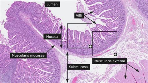 Small Intestine Study Guide - Inspirit