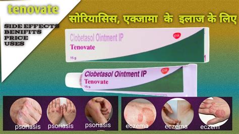 Tenovate Cream Uses In Marathi Online Shop | micoope.com.gt