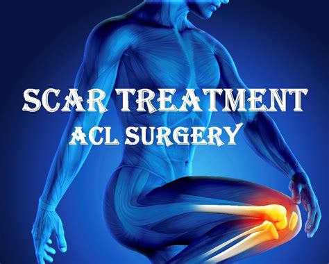 What Is The Best Treatment For A Scar After ACL Surgery?