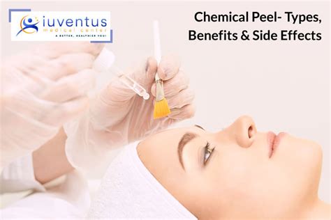 Chemical Peel- Types, Benefits & Side Effects - Iuventus Medical Center