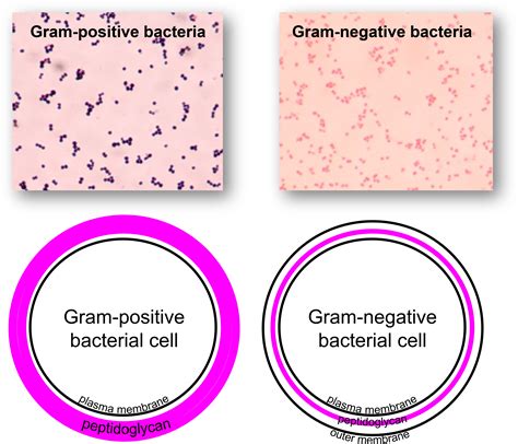 Gram Positive And Gram Negative Bacteria Gram Staining, 54% OFF