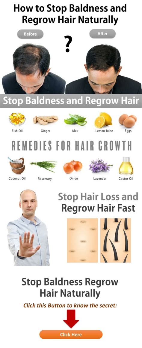 PPT - How to Hair Regrowth Treatment for Women PowerPoint Presentation - ID:10669722