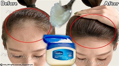 THIS VASELINE TRICK CAN HELP YOU REMOVE UNWANTED HAIR ! | Vaseline for ...