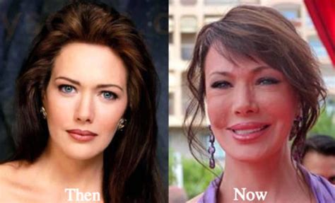 Hunter Tylo Plastic Surgery Before and After Photos - Latest Plastic ...