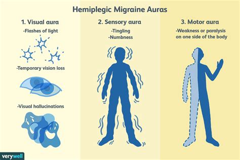 Hemiplegic Migraines: Symptoms, Causes, and Treatment