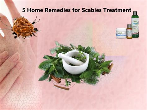 PPT - 5 Home Remedies for Scabies Treatment PowerPoint Presentation ...