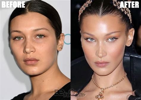 Bella Hadid Plastic Surgery Secrets EXPOSED!