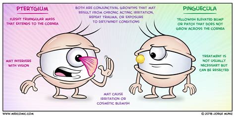 Pterygium vs. Pinguecula | Medcomic