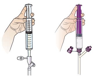 How to Use the Bolus Method With Your Feeding Tube | Memorial Sloan ...