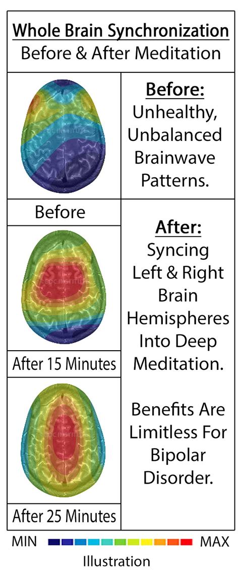 How Mindfulness Meditation Neutralizes Bipolar Disorder – EOC Institute