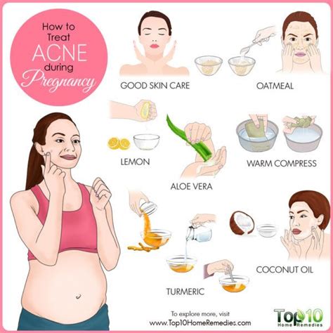 How to Treat Acne during Pregnancy | Top 10 Home Remedies