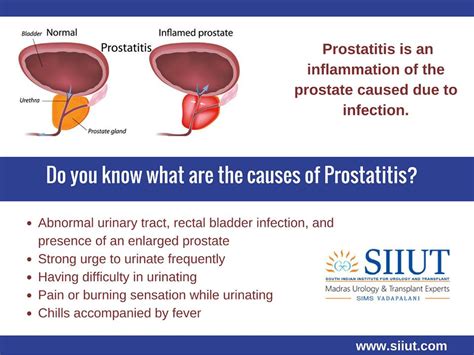 Antibiotics for prostatitis symptoms