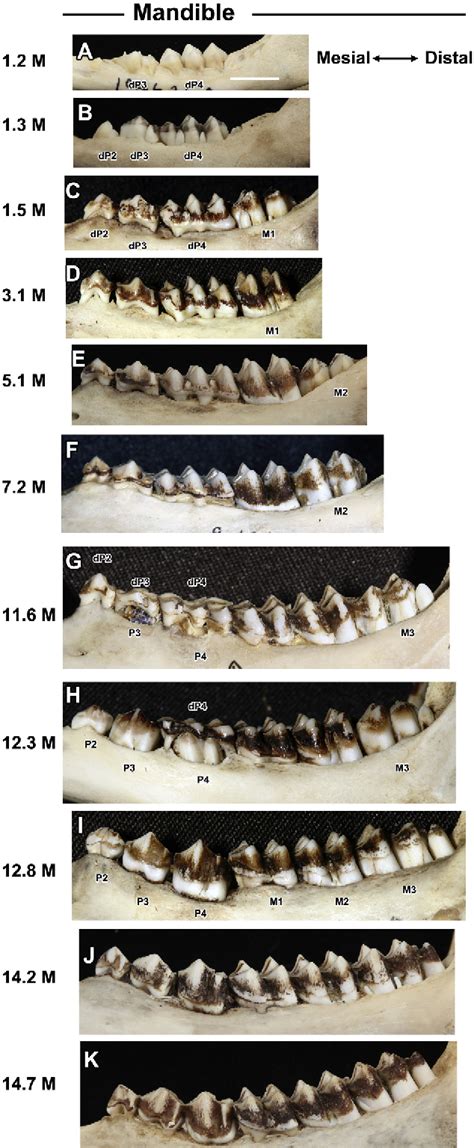 Figure 1 from Eruption of posterior teeth in the maxilla and mandible ...