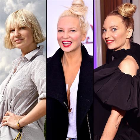 Sia Has Gotten Candid About Her Facelift and Liposuction: Plastic ...