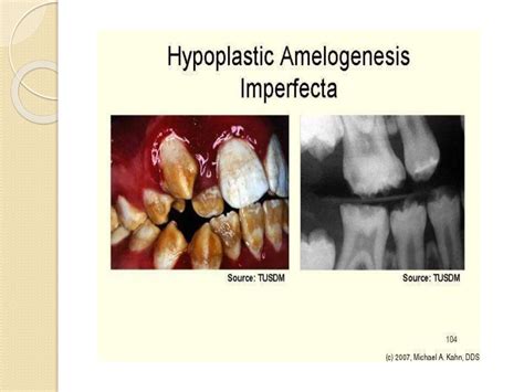 Amelogenesis (enamel formation) oral biology anf histology | PPT