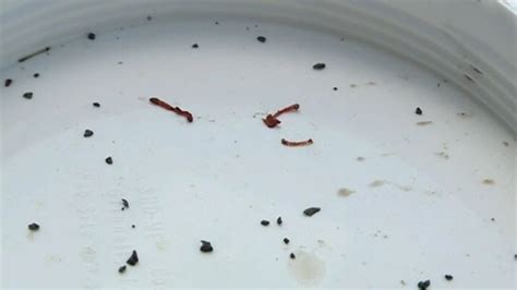 Blood Worms in Town's Water Prompt 'Do Not Drink' Order Video - ABC News