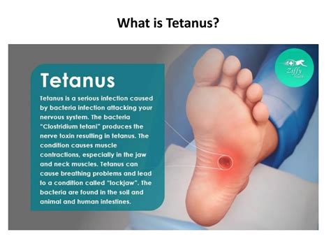 Clostridium Tetani Symptoms