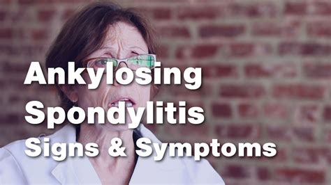 Ankylosing Spondylitis Archives - Johns Hopkins RheumTV