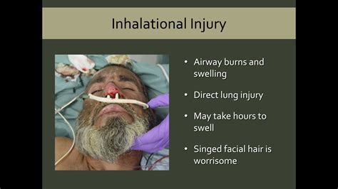 Does that Burn Casualty Need Intubation? - Crisis Medicine