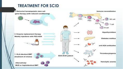 severe combined immunodeficiency syndrome