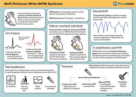 Wolf-Parkinson-White (WPW) Syndrome: Infographic - Visualmed