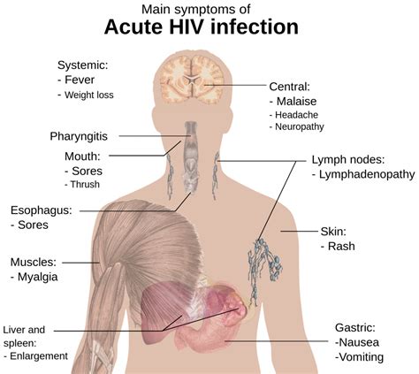 The Four Stages of HIV Explained