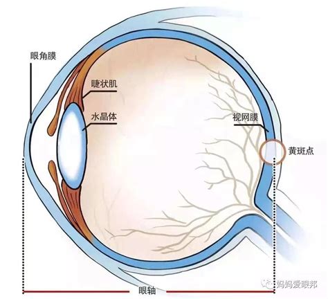 眼轴长度与近视和年龄的关系 - 知乎