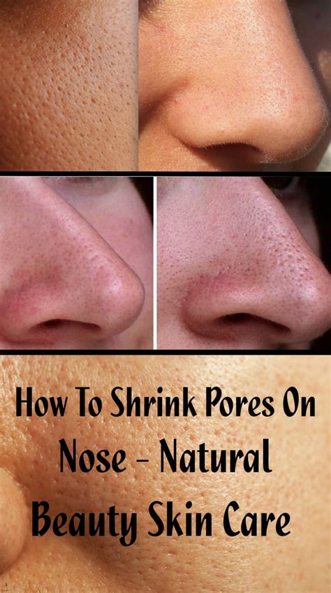 How To Shrink Pores On Nose – Natural Beauty Skin Care | Nose pores, Natural skin beauty ...