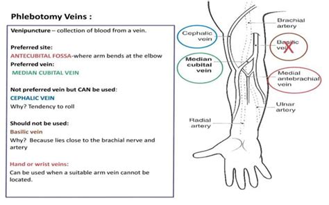 Venipuncture and Arterial Puncture Policy | Phlebotomy study ...