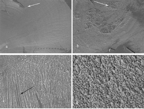 -Scanning electron micrograph showing anchovy otolith microstructure ...