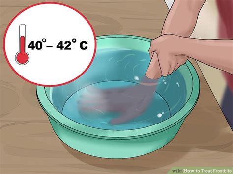 How to Treat Frostbite: 13 Steps (with Pictures) - wikiHow