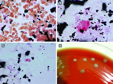 (A to C) Microscopic morphology in Gram stains of aerobic blood culture ...