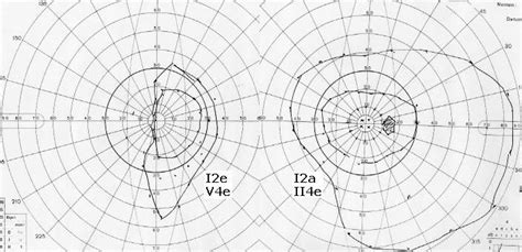 Visual Field Test Chart: A Visual Reference of Charts | Chart Master