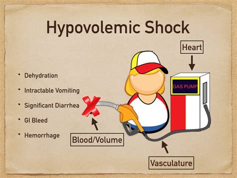 Types of Shock: Cardiogenic vs Hypovolemic vs Obstructive vs ...