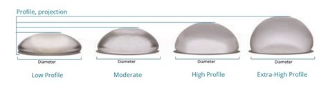 profiles breast implant projection - Gold Coast Plastic Surgery