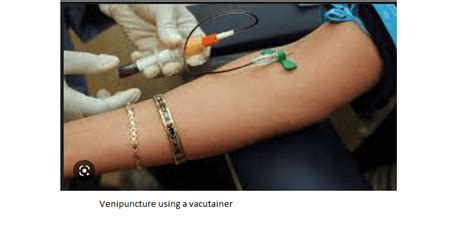 Routine venipuncture procedure - LaboratoryIntern