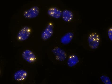 RNA FISH for long non-coding RNA | LGC Biosearch Technologies