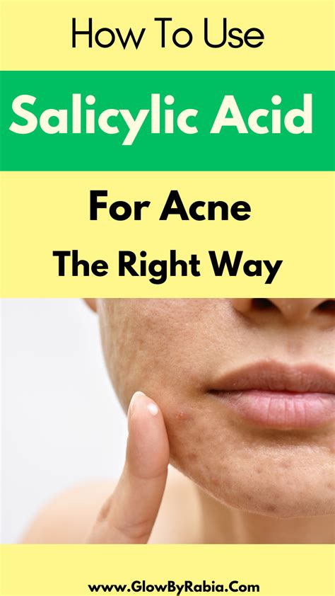 Pharmacist Picked- Best Salicylic acid products for acne | Salicylic acid, Salicylic acid acne ...