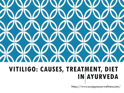 PPT - Vitiligo: Causes, Treatment, Diet in Ayurveda PowerPoint Presentation - ID:10589018