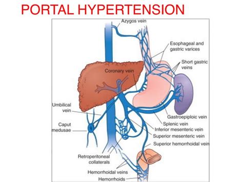 Portal hypertension : Causes, Symptoms, Complications and Management