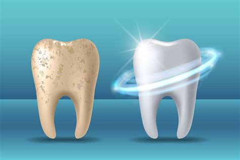 From NASA to Your Mouth: The Dental Benefits of Nano-hydroxyapatite ...