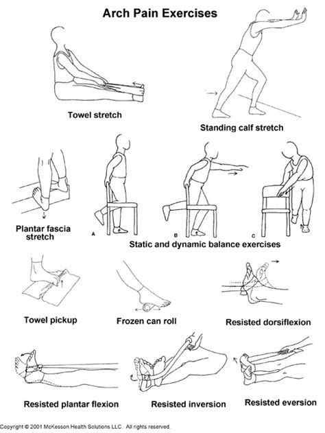 Sports Medicine Advisor 2003.1: Arch Pain Exercises: Illustration