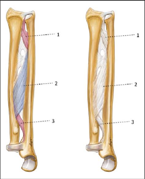 Distal radioulnar joint: functional anatomy, including pathomechanics | Semantic Scholar