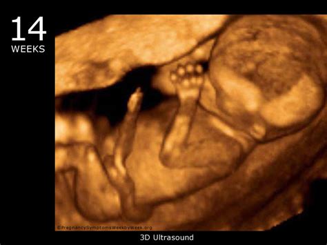 14 Week 3D Ultrasound Baby Picture | Pregnancy Symptoms Week by Week