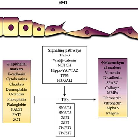 (a) E-cadherin expression is preserved in the epithelial component... | Download Scientific Diagram