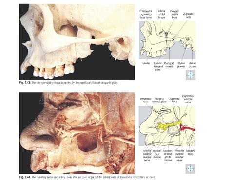 Pterygopalatine Fossa Anatomy - pediagenosis