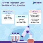 Understanding Rheumatoid Arthritis: Diagnosis and Lab Tests - Becker Spine