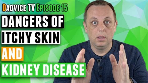 Itchy Skin & Chronic Kidney Disease - A sign of low kidney function & high phosphorus - YouTube ...
