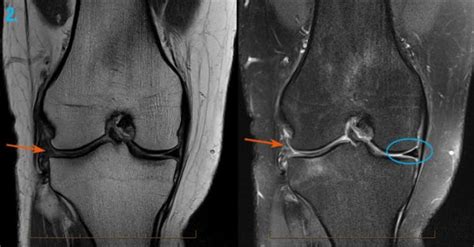 Knee Pain CT Scan Melbourne | Melbourne Radiology Clinic