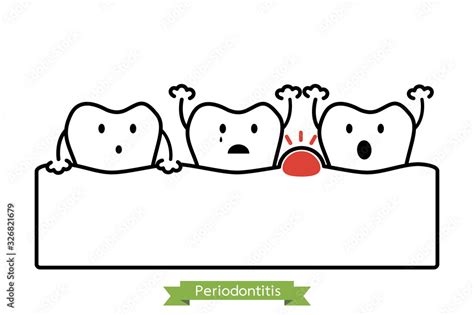 periodontitis or gum disease with swell ( gum and tooth is swollen because inflammation ...